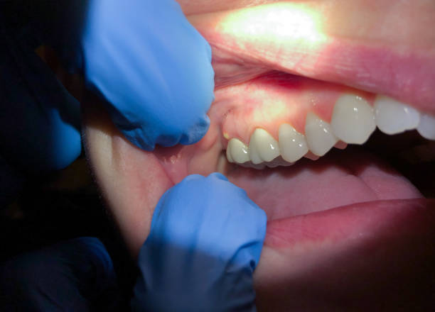 Best Tooth Infection Emergency Dentist  in Maine, WI